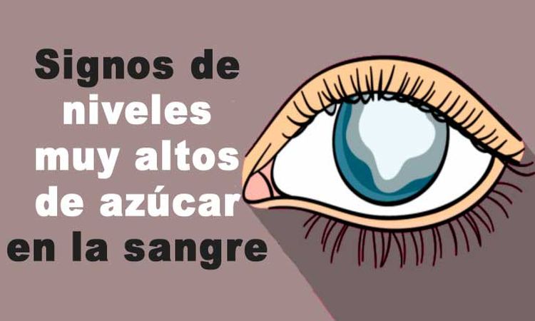 Signos de tener el azucar alta